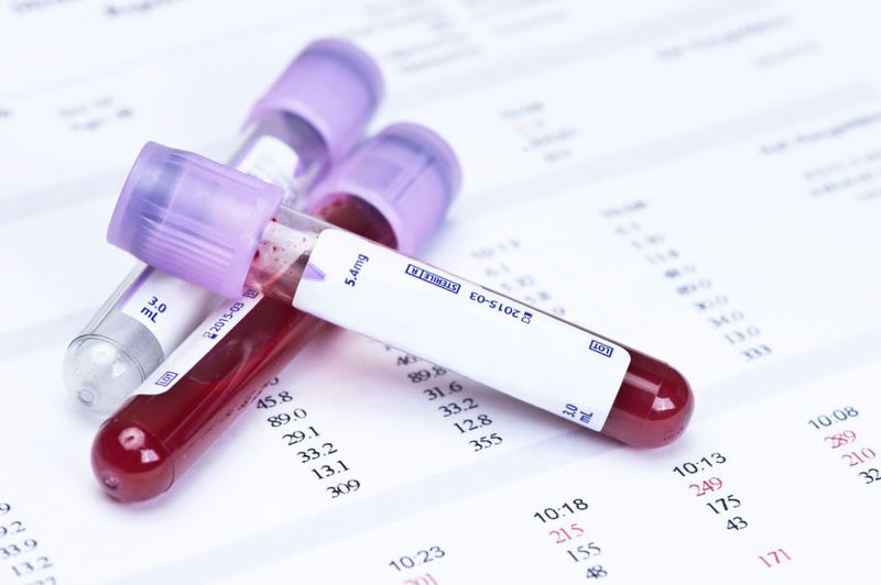 xét nghiệm công thức máu đánh giá yếu tố viêm trong cơ thể